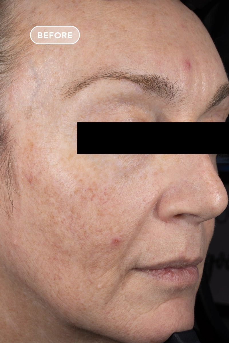 Free VOL.U.LIFT Volume Skin Firming Treatment